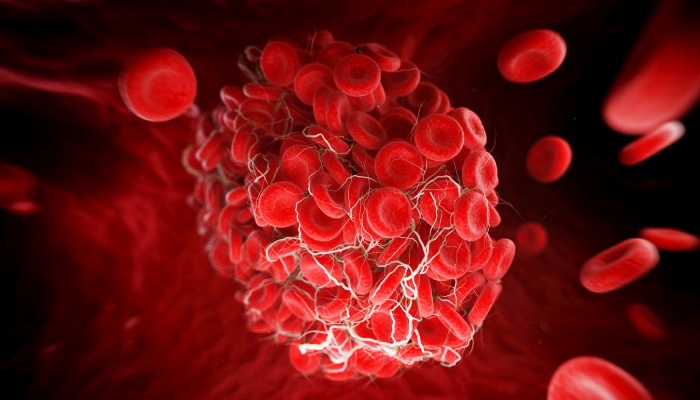 Understanding Nattokinase: What it is and how it works